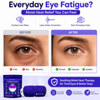 Eye Serenity Steam Eye Mask - Self-Heating Warm Eye Compress for Dry Eyes, Puffiness, Sleep & Travel